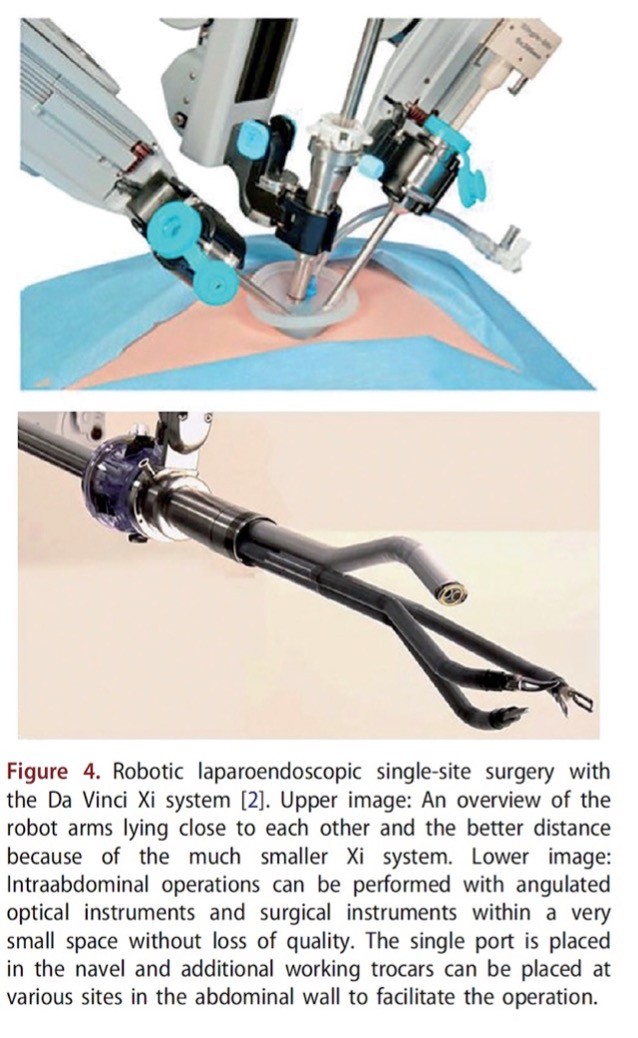 endoskopisi-robotiki-service-3.jpg
