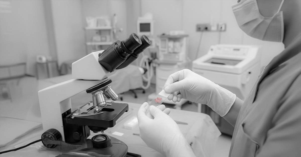 Διεγχειρητική ταχεία βιοψία στη γυναικολογική ογκολογία: Υπέρ, κατά και ο ρόλος της εξατομίκευσης